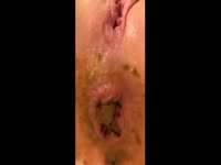 Poop Fetish Porn Tube - Slut in stockings fucks her dirty ass.